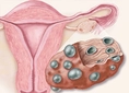 Kadınlarda Testosteron Hormonu Nedir?